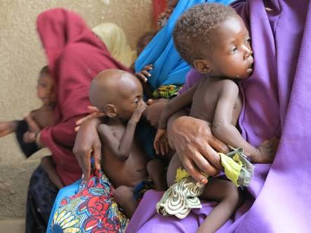 132 children die of malnutrition in Kaduna